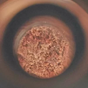 Ketama CBD ingrandimento sotto la lente del microscopio